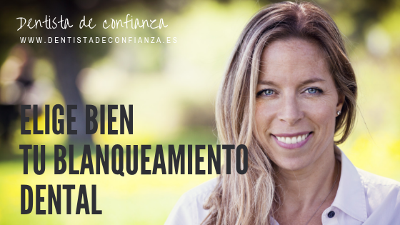 Elige bien tu blanqueamiento dental- Dentista de Confianza