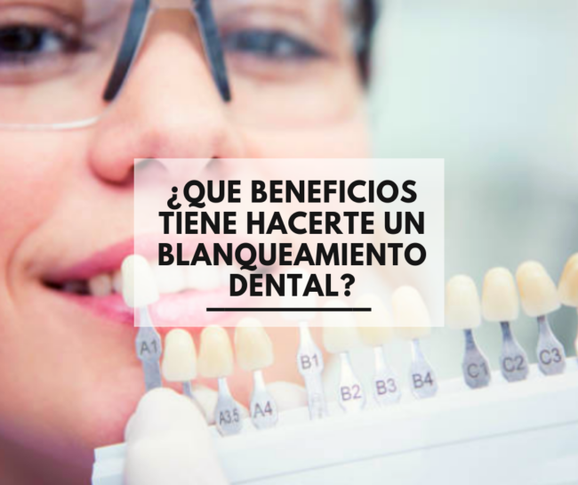 beneficios de blanqueamiento dental | Dentista de confianza