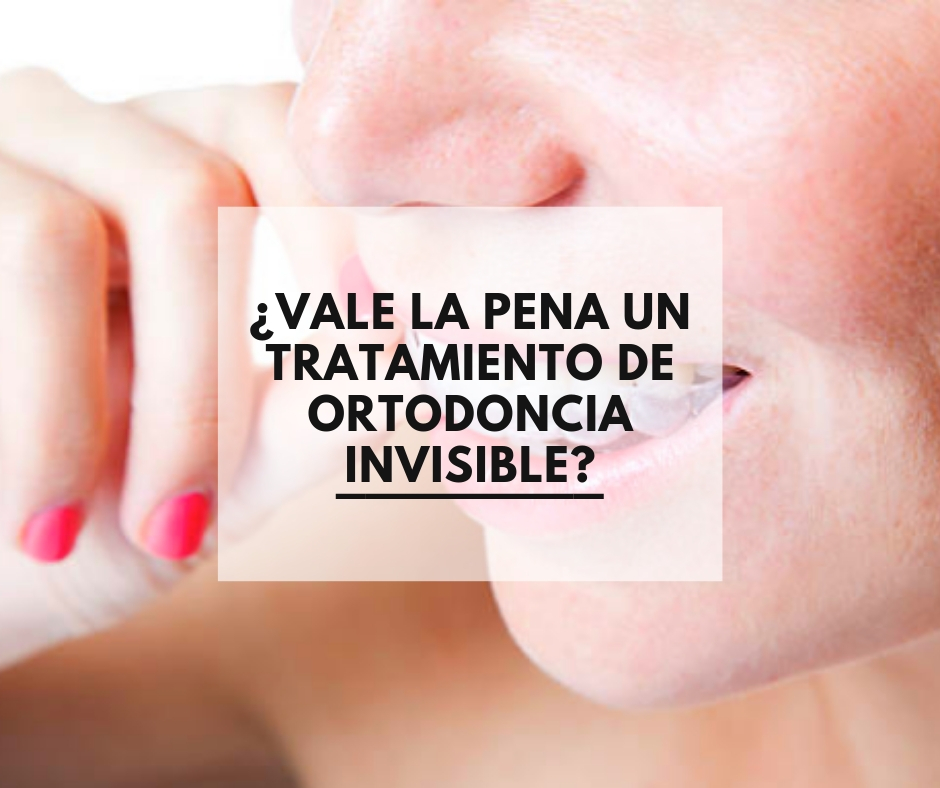 tratamiento de ortodoncia invisible | Dentista de confianza