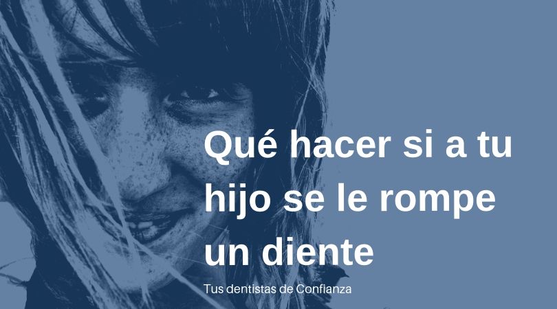 Qué hacer si tu hijo se rompe un diente- Dentistas de confianza