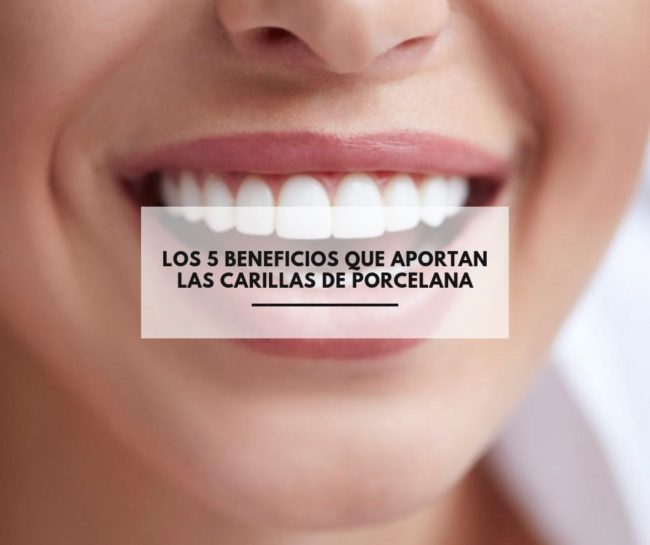 Los 5 beneficios que aportan las carillas de porcelana