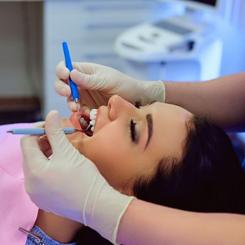 tratamiento de las carillas dentales