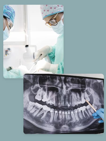clinica dental maxilofacial en madrid